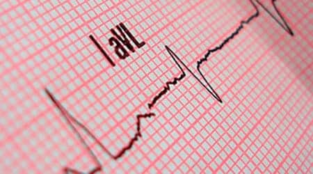 close up illustration showing line measuring heart beat on EKG machine