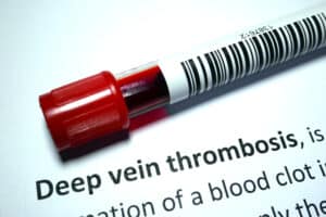 iStock 96Deep vein thrombosis - blood disorder abstract.4047984