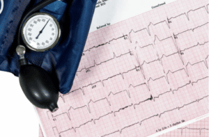 Ecocardiography test reports ECG one showing abnormal heart rhythm and a blood pressure cuff